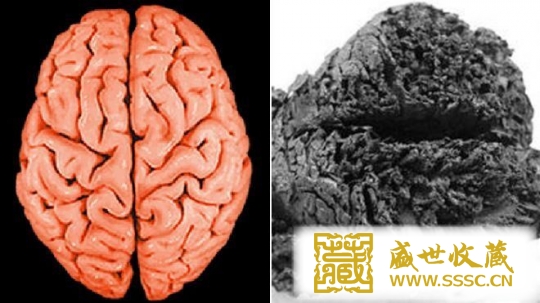这颗大脑的发现将有助于研究现代人大脑疾病的病因